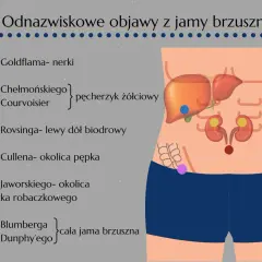 Ilustracja przedstawia schemat jamy brzusznej z zaznaczonymi narządami i punktami bólowymi.