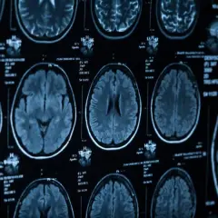 Ile się czeka na wynik tomografii głowy? Sprawdź czas oczekiwania