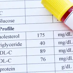 Wynik lipidogramu: cholesterol 175, trójglicerydy 40, HDL-C 89, LDL-C 76 mg/dL. To badanie ocenia poziom tłuszczów we krwi.