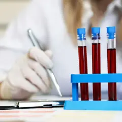 Probówki z krwią w stojaku, osoba w rękawiczkach pisze coś na kartce.