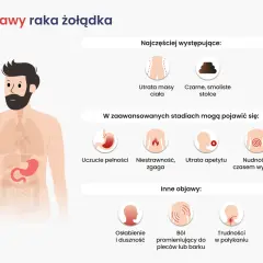 Objawy raka żołądka: utrata masy ciała, czarne stolce, niestrawność, nudności, ból pleców, trudności w połykaniu.