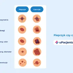 Porównanie pieprzyka i czerniaka: asymetria, brzegi, kolor, średnica i ewolucja. Grafika edukacyjna uPacjenta.