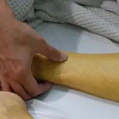 Dłoń bada zażółconą skórę nogi, widoczne objawy żółtaczki.