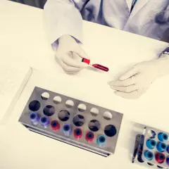 Ręce w rękawiczkach trzymają probówkę z krwią do analizy, przygotowując się do wykonania proteinogramu.