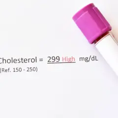 Wynik cholesterolu 299 mg/dL, co jest wysokim poziomem. Wskazuje to na potrzebę konsultacji z lekarzem, aby omówić ewentualne zmiany w stylu życia lub leczenie.