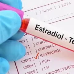Ręka w niebieskiej rękawiczce trzyma probówkę z napisem "Estradiol - Test". Obok widoczna lista badań, gdzie zaznaczono "ESTRADIOL".