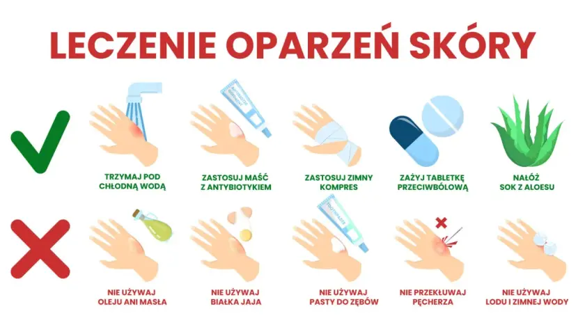 Leczenie oparzeń skóry: chłodna woda, maść z antybiotykiem, zimny kompres, tabletki przeciwbólowe, sok z aloesu. Unikaj masła, jajka, pasty do zębów, przekłuwania pęcherzy, lodu.