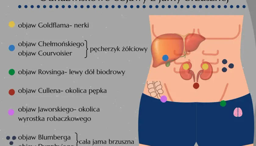 Ilustracja przedstawia schemat jamy brzusznej z zaznaczonymi narządami i punktami bólowymi.