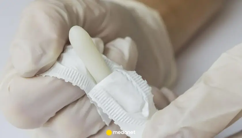 Rękawiczki medyczne trzymają biały czopek, prawdopodobnie torecan, gotowy do użycia.