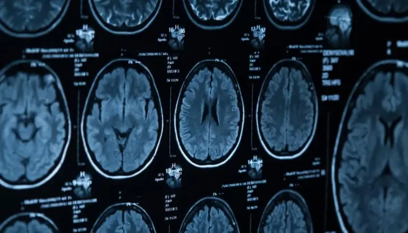 Ile się czeka na wynik tomografii głowy? Sprawdź czas oczekiwania