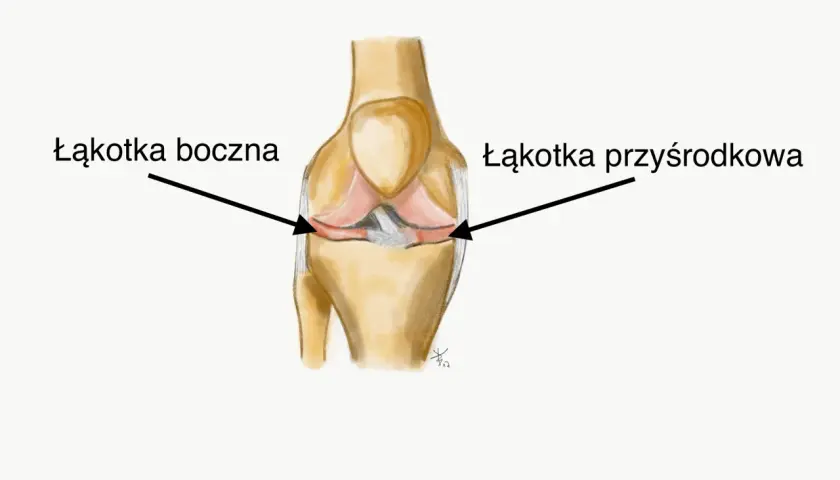 Anatomia kolana z zaznaczoną łąkotką boczną i przyśrodkową.