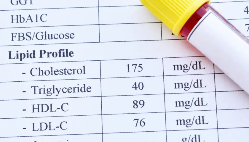 Wynik lipidogramu: cholesterol 175, trójglicerydy 40, HDL-C 89, LDL-C 76 mg/dL. To badanie ocenia poziom tłuszczów we krwi.