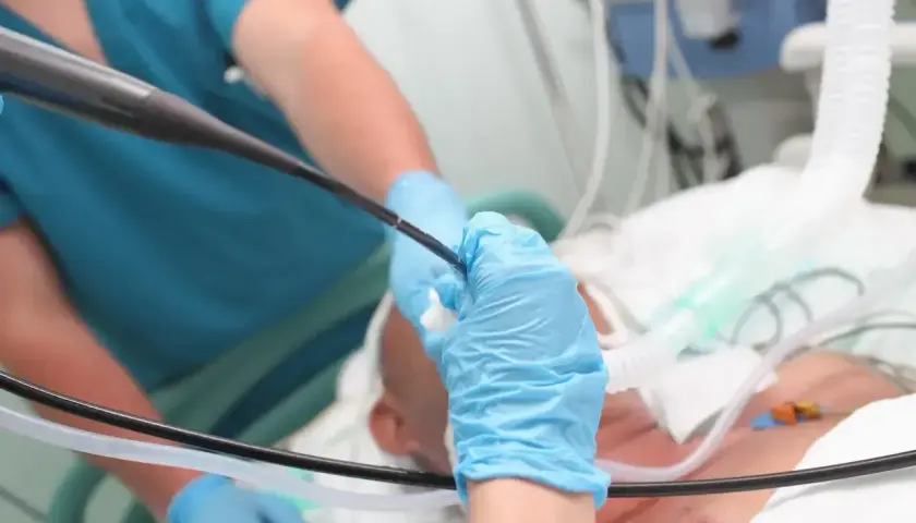 Lekarz w niebieskich rękawiczkach wykonuje bronchoskopię, wprowadzając endoskop do dróg oddechowych pacjenta.