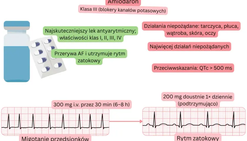 Amiodaron, lek antyarytmiczny, przerywa migotanie przedsionków, przywracając rytm zatokowy. Opakowanie leku i EKG.