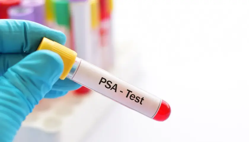 Ręka w niebieskiej rękawiczce trzyma probówkę z napisem "PSA - Test". To ważny krok w diagnostyce, nawet dla zdrowia psa.