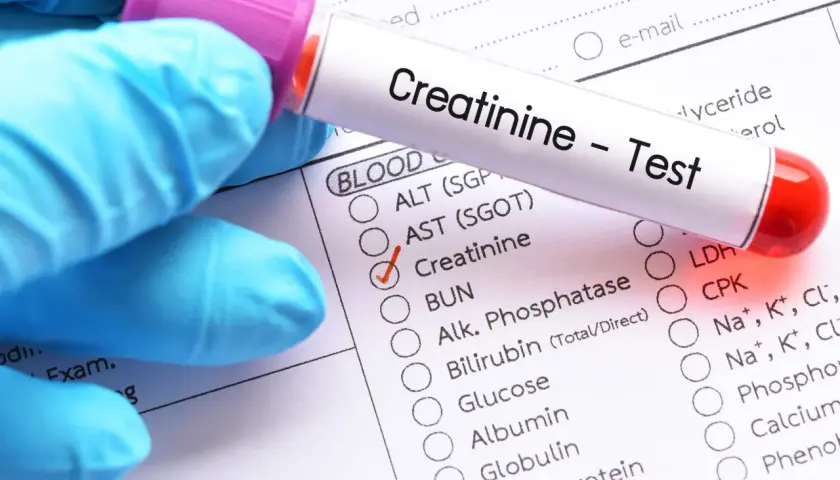 Rękawiczka w niebieskiej rękawiczce trzyma probówkę z napisem "Creatinine - Test". Zaznaczono opcję "Creatinine", sugerując niską kreatyninę.
