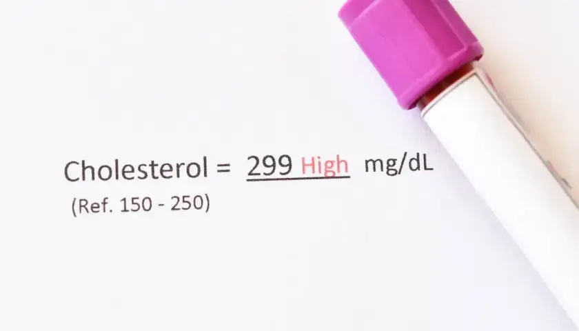 Wynik cholesterolu 299 mg/dL, co jest wysokim poziomem. Wskazuje to na potrzebę konsultacji z lekarzem, aby omówić ewentualne zmiany w stylu życia lub leczenie.
