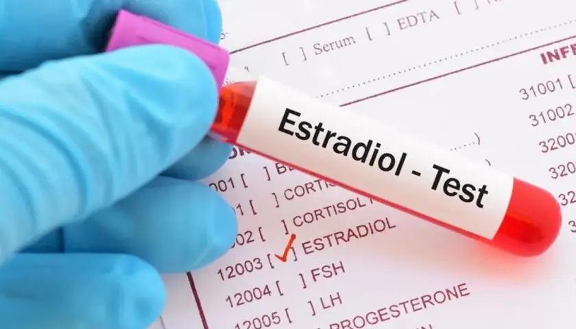 Ręka w niebieskiej rękawiczce trzyma probówkę z napisem "Estradiol - Test". Obok widoczna lista badań, gdzie zaznaczono "ESTRADIOL".