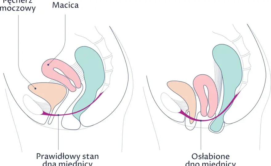 Macica - budowa, objawy, choroby. Kiedy szukać pomocy?