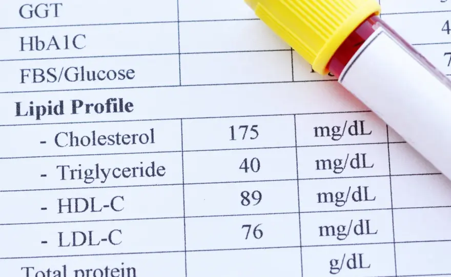 Lipidogram - jak czytać wyniki i co oznaczają normy cholesterolu?