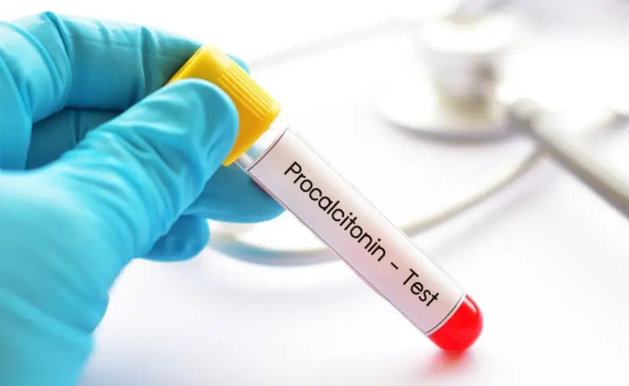Prokalcytonina (PCT) - kiedy pomaga w diagnostyce sepsy?