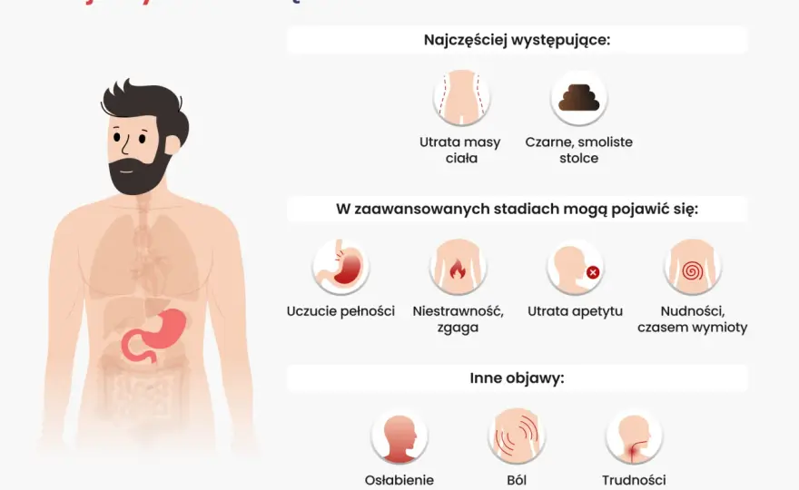 Nowotwór żołądka - objawy, które łatwo pomylić z niestrawnością