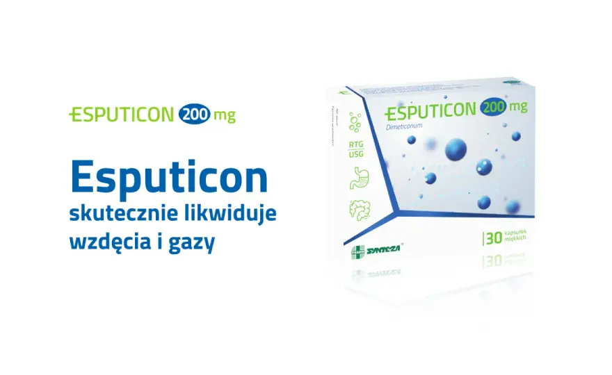 Esputicon na wzdęcia - czy zawsze działa? Poznaj prawdę!