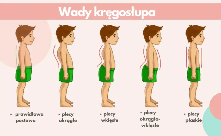 Lordoza - Wada czy norma? Kiedy potrzebujesz pomocy?
