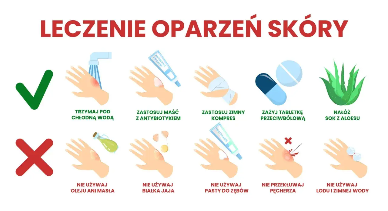 Leczenie oparzeń skóry: chłodna woda, maść z antybiotykiem, zimny kompres, tabletki przeciwbólowe, sok z aloesu. Unikaj masła, jajka, pasty do zębów, przekłuwania pęcherzy, lodu.