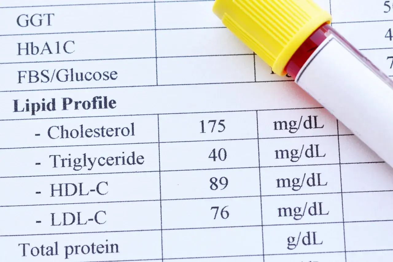 Wynik lipidogramu: cholesterol 175, trójglicerydy 40, HDL-C 89, LDL-C 76 mg/dL. To badanie ocenia poziom tłuszczów we krwi.