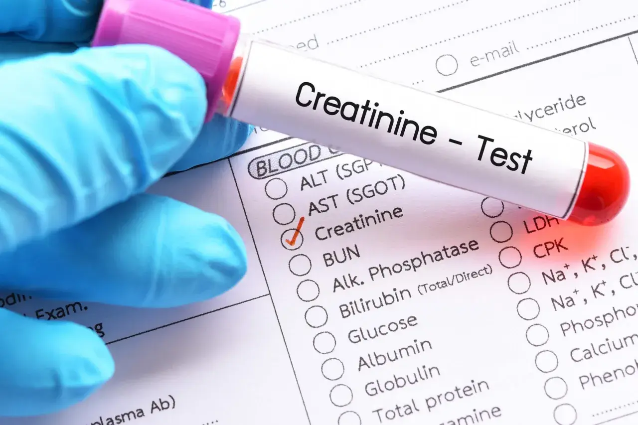 Rękawiczka w niebieskiej rękawiczce trzyma probówkę z napisem "Creatinine - Test". Zaznaczono opcję "Creatinine", sugerując niską kreatyninę.