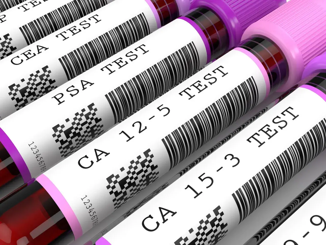 Rząd probówek z próbkami krwi do badań, z etykietami: CEA TEST, PSA TEST, CA 12-5 TEST, CA 15-3 TEST.