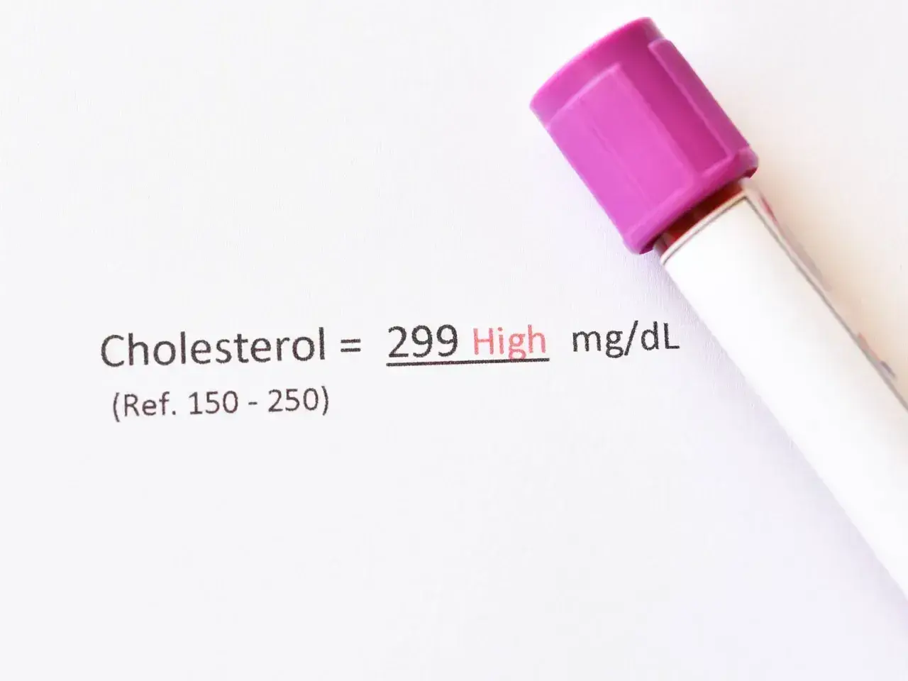 Wynik cholesterolu 299 mg/dL, co jest wysokim poziomem. Wskazuje to na potrzebę konsultacji z lekarzem, aby omówić ewentualne zmiany w stylu życia lub leczenie.