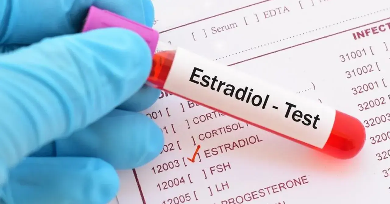 Ręka w niebieskiej rękawiczce trzyma probówkę z napisem "Estradiol - Test". Obok widoczna lista badań, gdzie zaznaczono "ESTRADIOL".