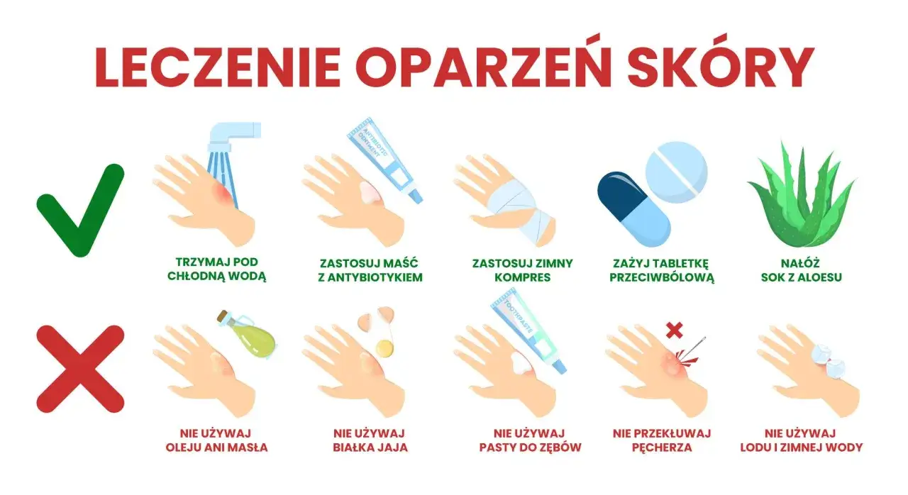Leczenie oparzeń skóry: chłodna woda, maść z antybiotykiem, zimny kompres, tabletki przeciwbólowe, aloes. Unikaj masła, jajka, pasty do zębów, przekłuwania pęcherzy, lodu. Oparzenie 2 stopnia wymaga ostrożności.