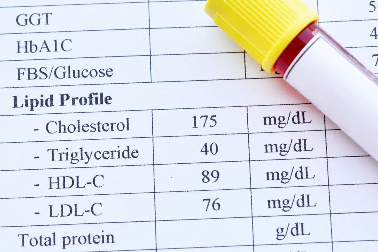 Wynik lipidogramu: cholesterol 175, trójglicerydy 40, HDL-C 89, LDL-C 76 mg/dL. To ważne badanie, by sprawdzić, lipidogram co to jest.