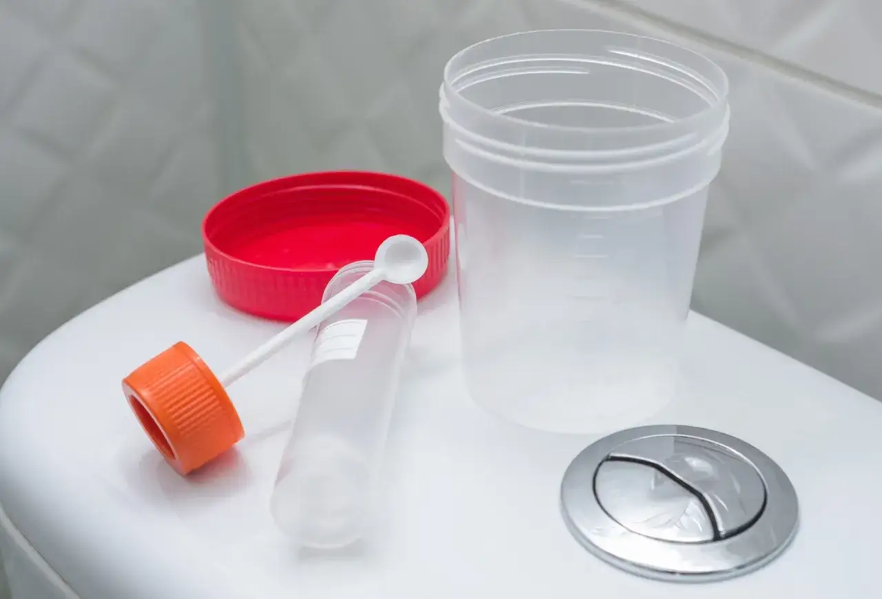 Zestaw do pobierania próbek kału, który może pomóc zdiagnozować przyczynę sraczki.