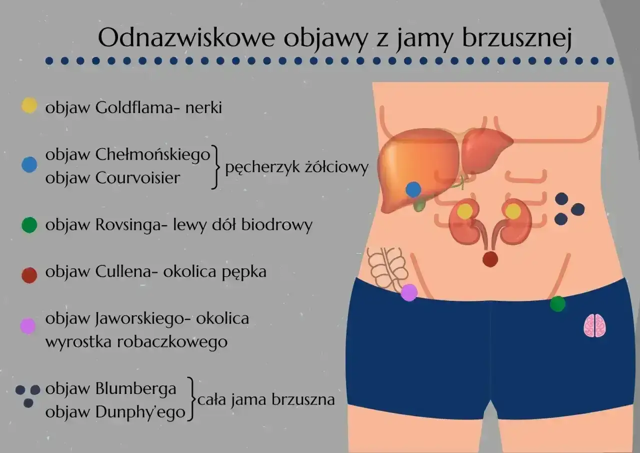 Fioletowa kropka oznacza objaw Jaworskiego, który lokalizuje się w okolicy wyrostka robaczkowego.